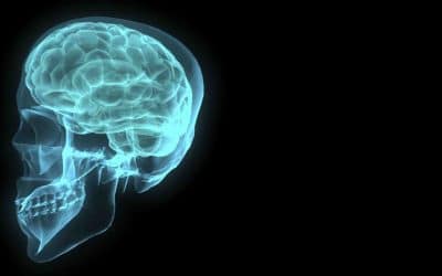 Brain perfusion imaging with voxel-based analysis in secondary progressive multiple sclerosis patients with a moderate to severe stage of disease: a boon for the workforce.