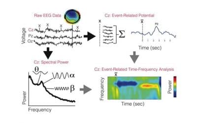 Use of EEG to diagnose ADHD