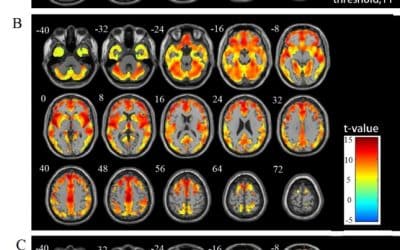 Age-Related Gray and White Matter Changes in Normal Adult Brains