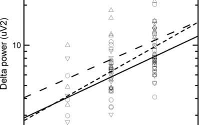 Interictal quantitative EEG in migraine: a blinded controlled study