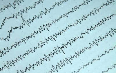 EEG neurofeedback: a brief overview and an example of peak alpha frequency training for cognitive enhancement in the elderly