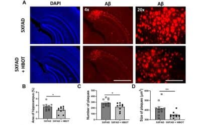 Hyperbaric oxygen therapy alleviates vascular dysfunction and amyloid burden in an Alzheimer’s disease mouse model and in elderly patients