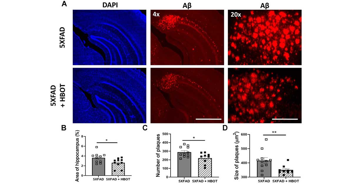 Hyperbaric Oxygen Therapy Alleviates Vascular Dysfunction in Alzheimer's