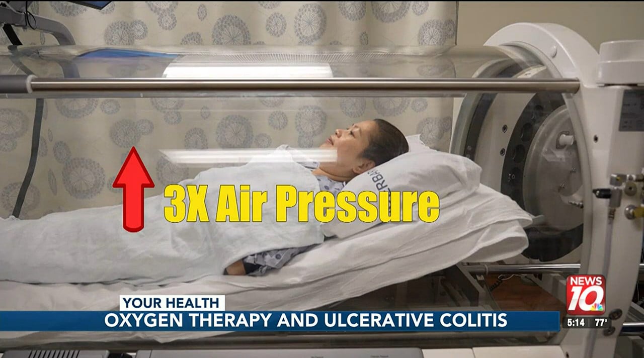 Your Health Oxygen therapy and ulcerative colitis ExtivitaRTP