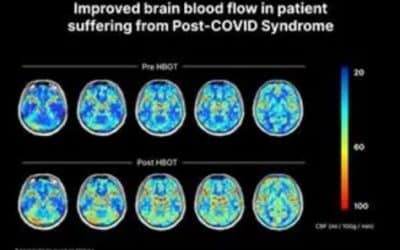 Effective treatment is now available for millions suffering with long COVID symptoms