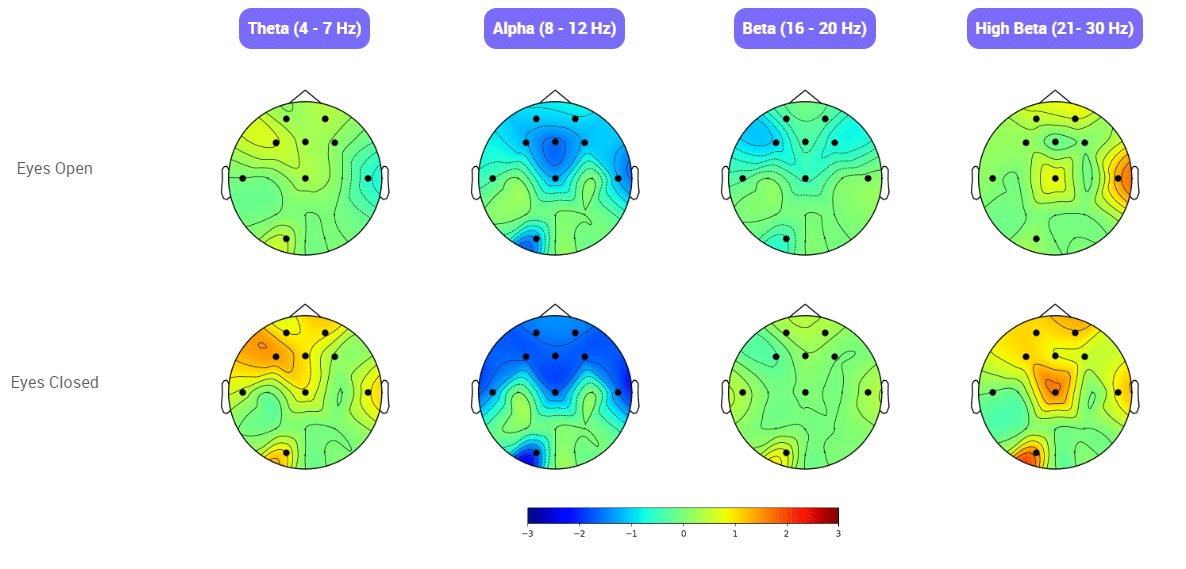 qEEg